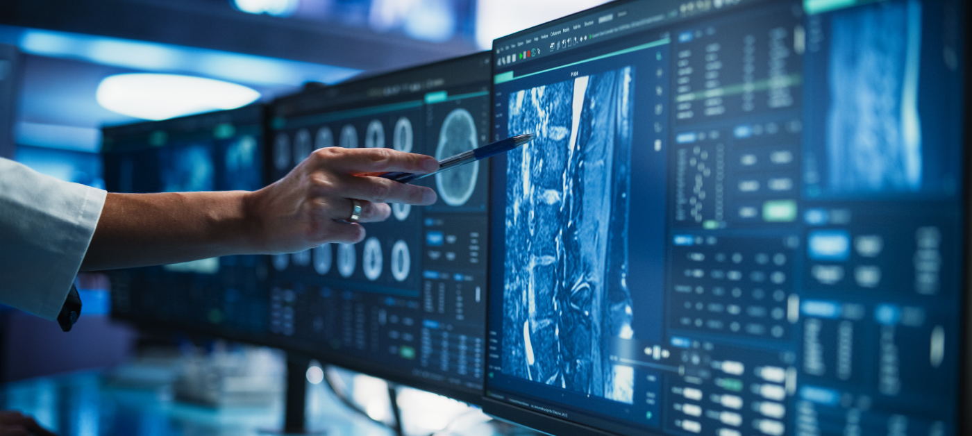 Medical professional analyzing AI-powered diagnostic imaging on multiple high-resolution screens in a modern healthcare facility.